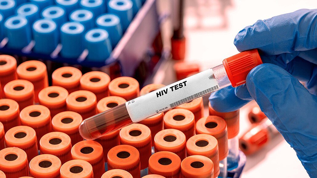 HIV v Česku dál přibývá. Případy nejsou jen ve velkých městech, týkají se i Jihomoravského kraje