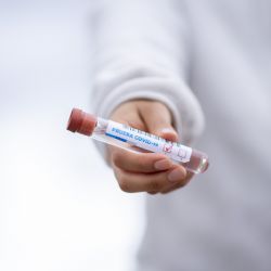 Vláda schválila pravidelné testování zaměstnanců a OSVČ, i návrhy na znovuzavedení krizového ošetřovného a příspěvku pro lidi v karanténě